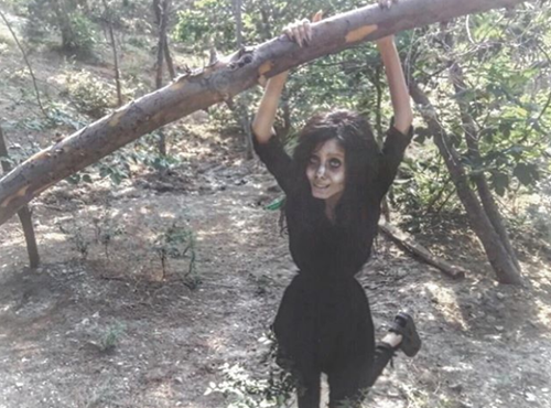 วัยรุ่นอิหร่าน วัย 19 ปี ทำศัลยกรรมกว่า 50 ครั้ง เพื่อให้หน้าเหมือนแองเจลินา โจลี