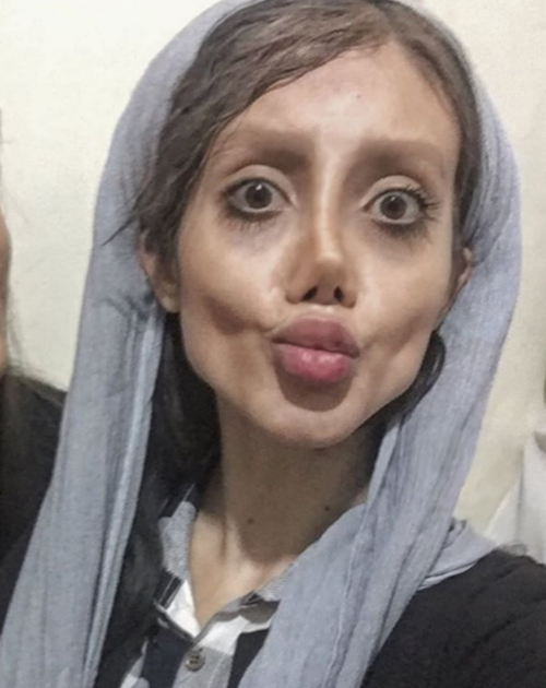 วัยรุ่นอิหร่าน วัย 19 ปี ทำศัลยกรรมกว่า 50 ครั้ง เพื่อให้หน้าเหมือนแองเจลินา โจลี