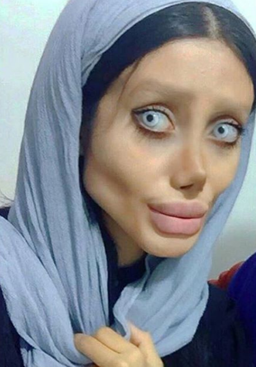 วัยรุ่นอิหร่าน วัย 19 ปี ทำศัลยกรรมกว่า 50 ครั้ง เพื่อให้หน้าเหมือนแองเจลินา โจลี