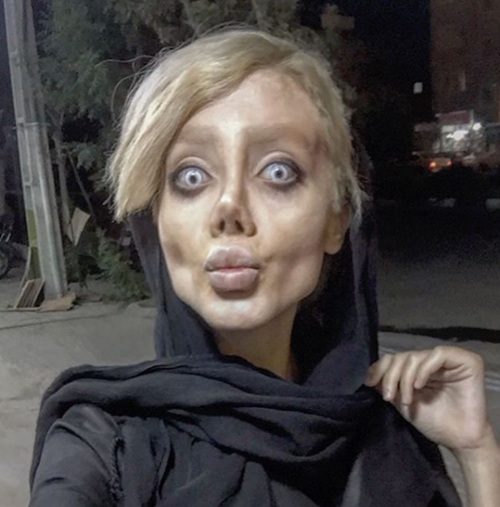 วัยรุ่นอิหร่าน วัย 19 ปี ทำศัลยกรรมกว่า 50 ครั้ง เพื่อให้หน้าเหมือนแองเจลินา โจลี