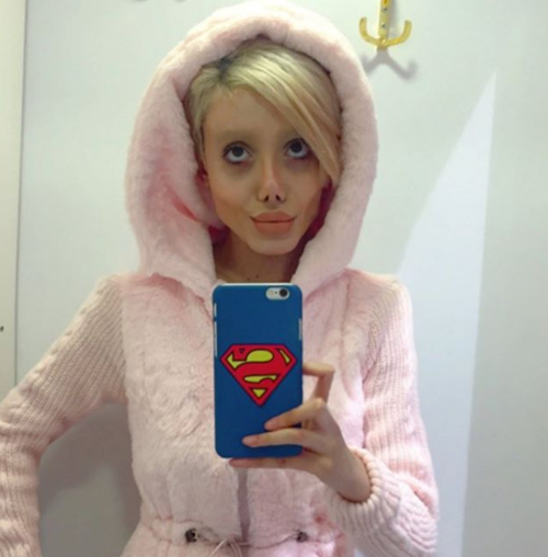 วัยรุ่นอิหร่าน วัย 19 ปี ทำศัลยกรรมกว่า 50 ครั้ง เพื่อให้หน้าเหมือนแองเจลินา โจลี