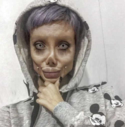 วัยรุ่นอิหร่าน วัย 19 ปี ทำศัลยกรรมกว่า 50 ครั้ง เพื่อให้หน้าเหมือนแองเจลินา โจลี