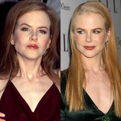 Nicole Kidman