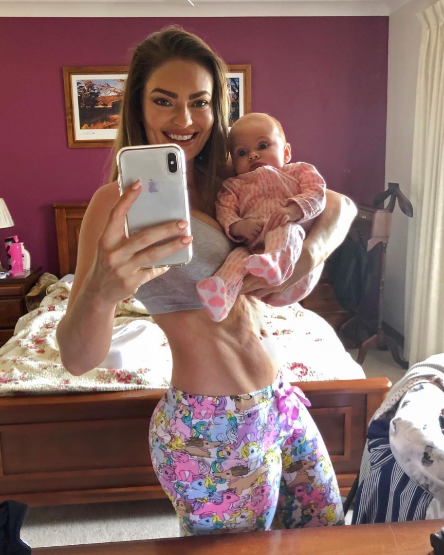 Emily Skye