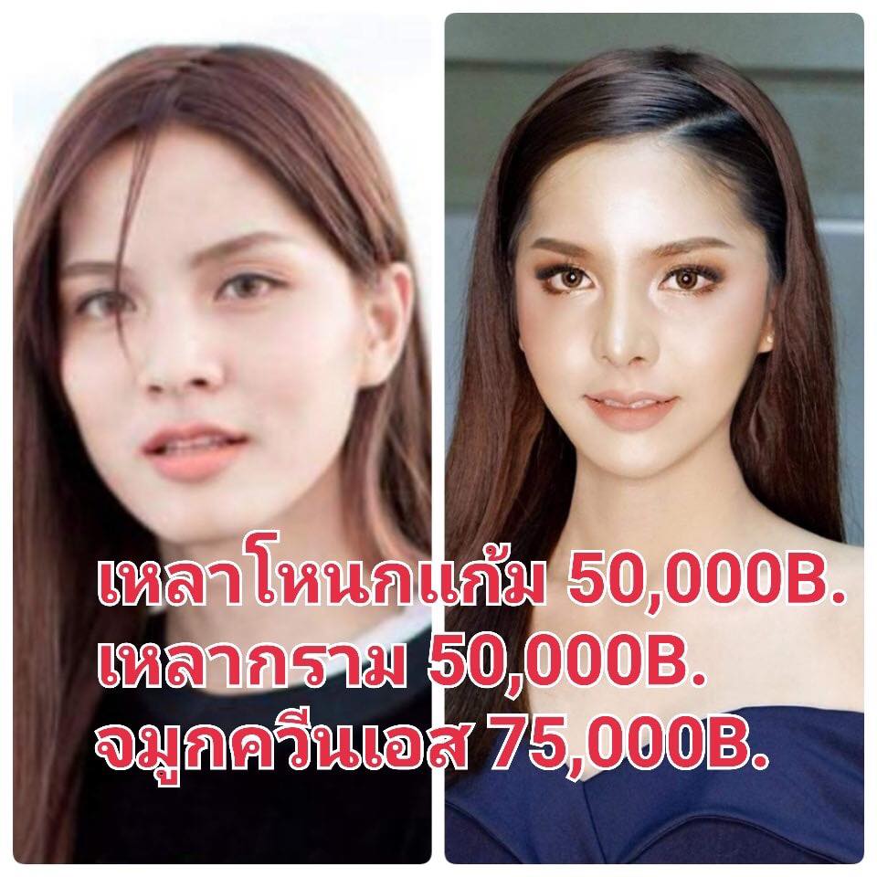 ศัลยกรรม