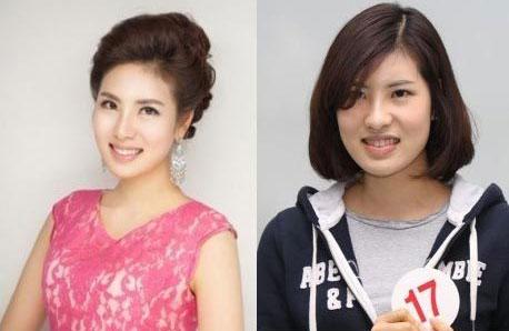 ศัลยกรรมเกาหลี