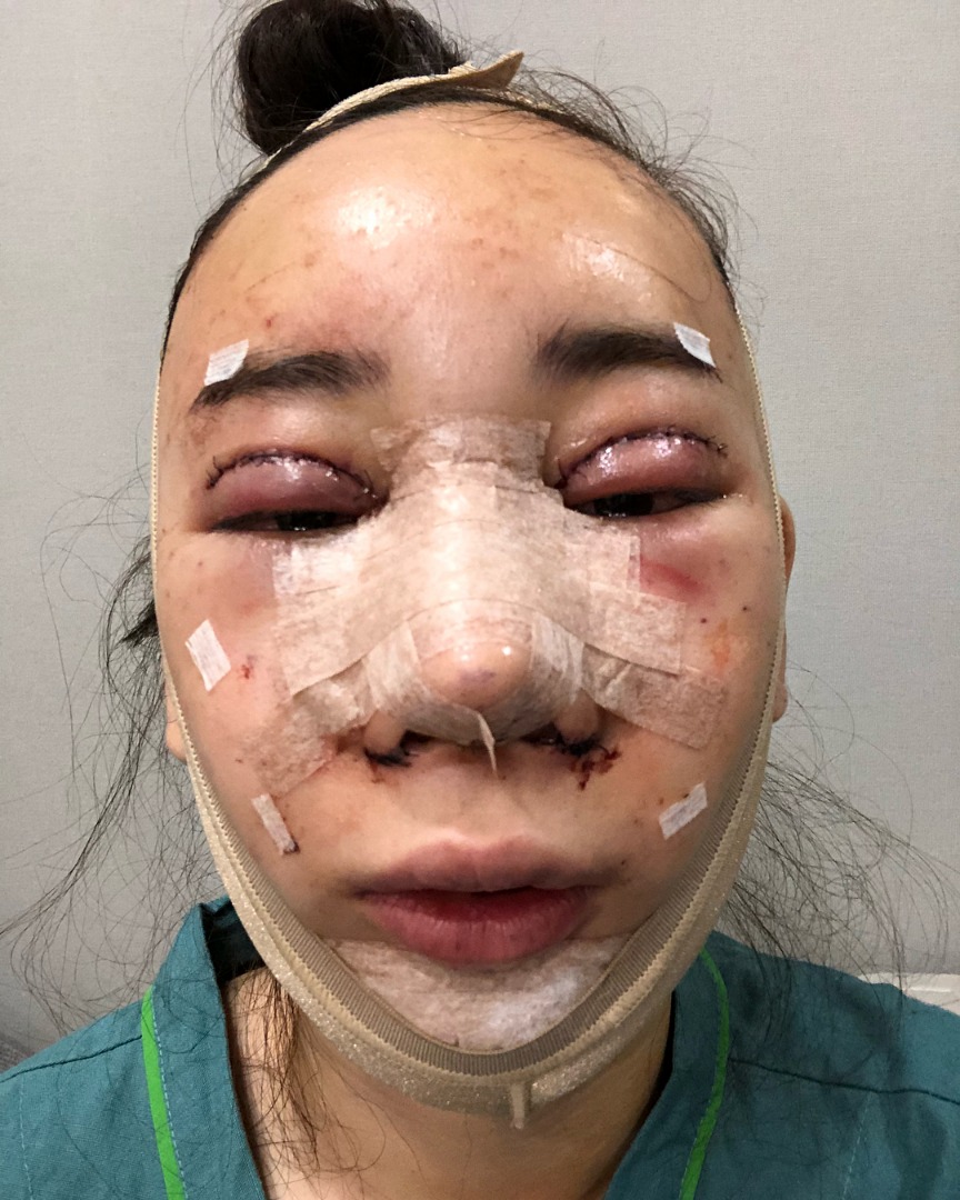 น้ำเพชร