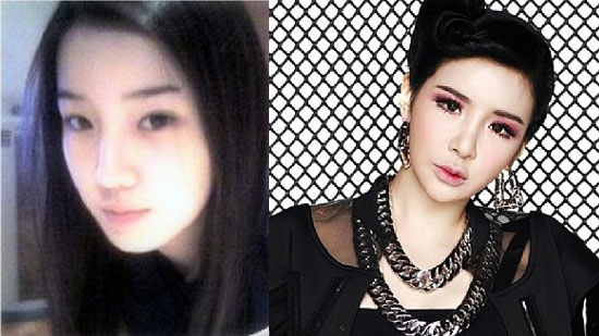 ดาราเกาหลีศัลยกรรม