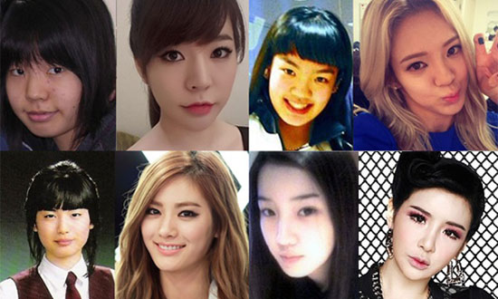 ดาราเกาหลีศัลยกรรม