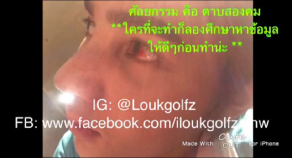 ศัลยกรรม