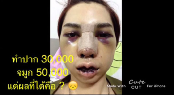 ศัลยกรรม