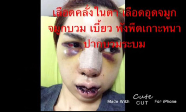 ศัลยกรรม