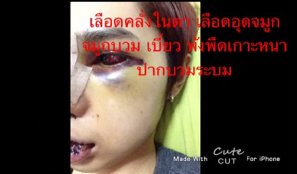 ศัลยกรรม