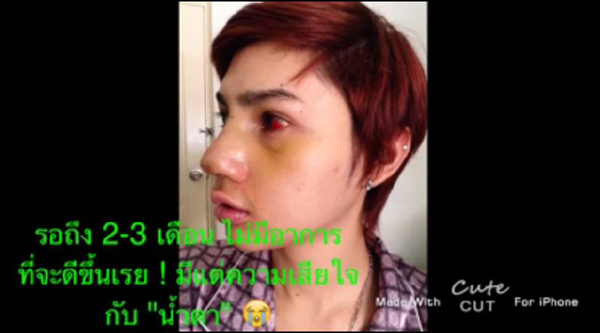ศัลยกรรม
