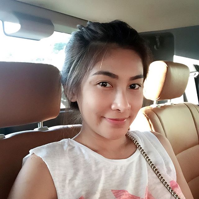 นุ่น รมิดา ศัลยกรรม