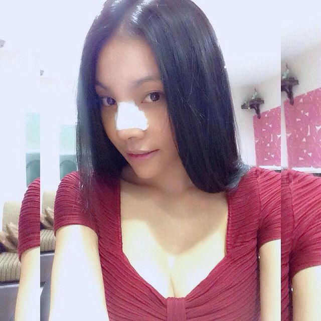 เอมมี่ แม็กซิม ศัลยกรรม