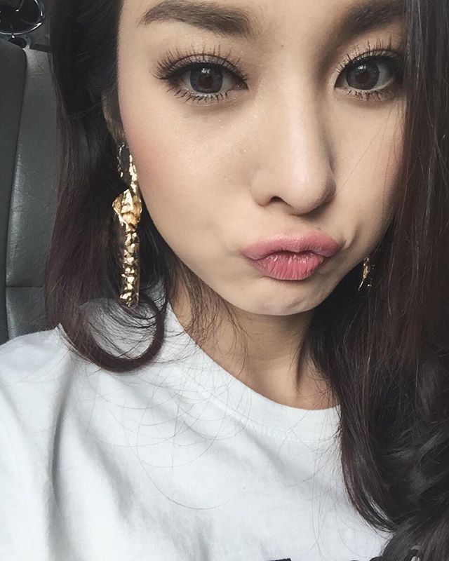 มด ณปภัทร ศัลยกรรม