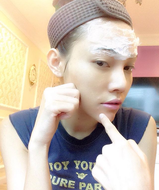 เอมมี่ แม็กซิม ศัลยกรรม