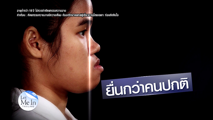 เฟิร์น let me in